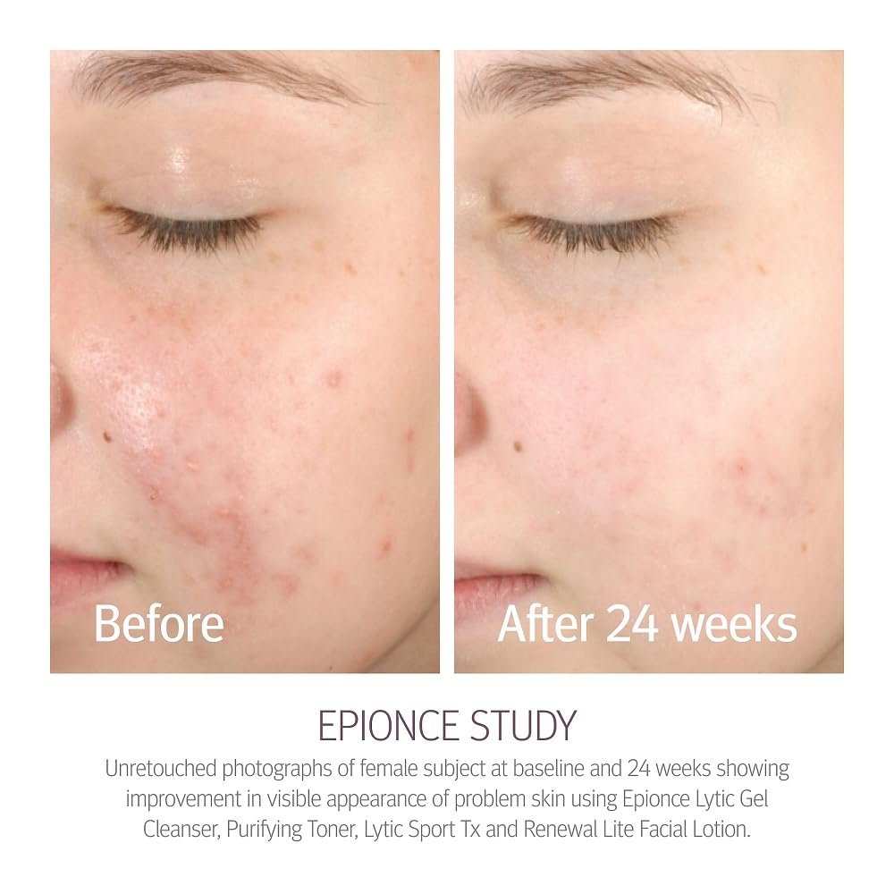 Peptide-infused lightweight hydrating moisturizer lotion for combination and oily skin with anti-aging benefits — view 3