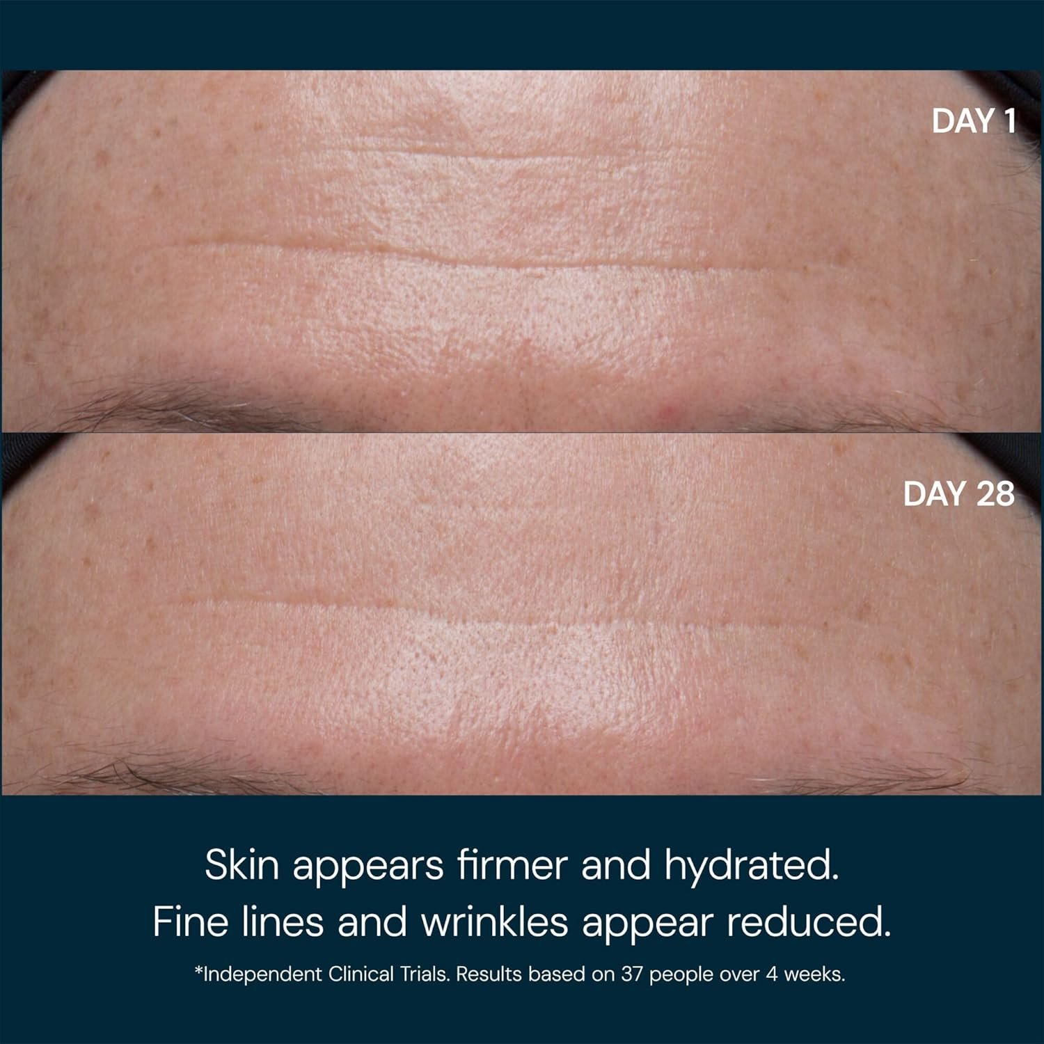 Marine Collagen anti-wrinkle moisturizer cream with SPF 30 for all skin types, lightweight daily facial protectant — side