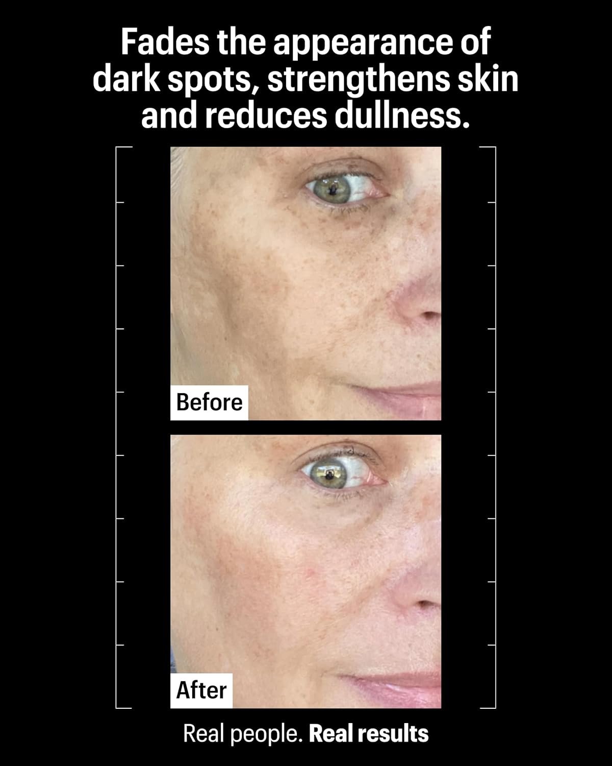 Tranexamic acid brightening serum bottle with peptides, shown on all skin types for dark spot reduction and anti-aging benefits — view 3